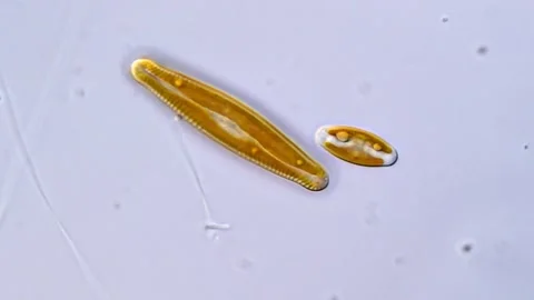 Diatom microorganism under DIC microscope 库存影片 317254318