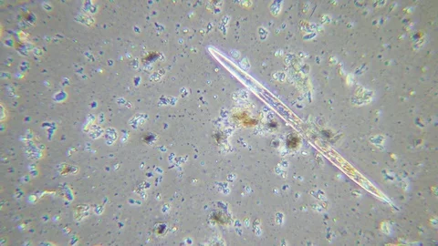 Diatom in sewage under Phase contrast Microscope Video stock 80429132