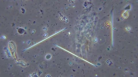Diatom in sewage under Phase contrast Microscope Video stock 80434700