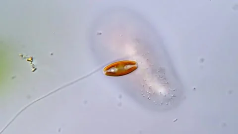 Diatom Skeletons in Close-Up Microscopic View Vídeos de archivo 317254301