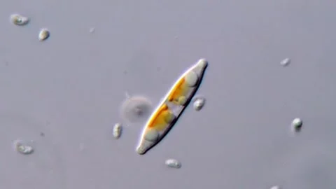 Diatom under DIC microscopy view 库存影片 317254046