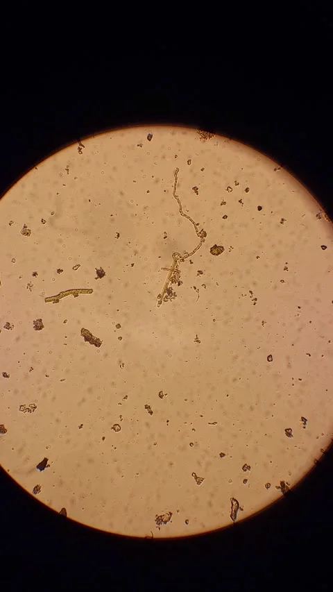 Diatom under microscope Vídeos de archivo 331847152