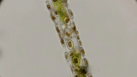 Diatoms Cocconeis fixed on filamentous algae, under a microscope Stock Footage 92994009