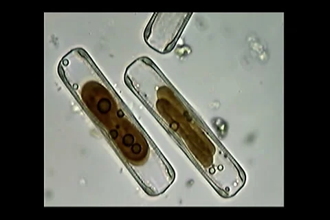 Diatoms Video stock 1183819