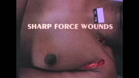 The difference between laceration and sharp wounds are explained on dead bodies Stock Footage 159331095