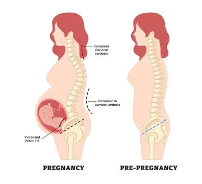 Difference between pregnancy vs pre-pregnancy spine posture, educational me.. Stock Illustration