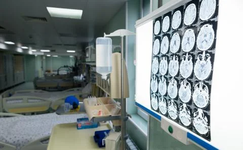 Different brain activity is seen on a x-ray screen in a neurology clinic in t Stock Photos