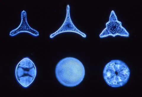 Different diatoms under the microscope 100x 库存照片
