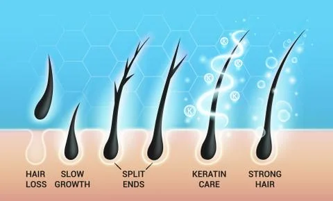 Different hair problems and deep salon treatment vector illustrations set, macro イラスト素材