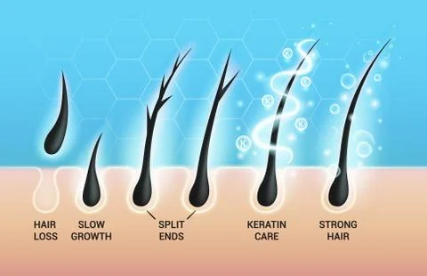 Different hair problems and deep salon treatment vector illustrations set, macro イラスト素材