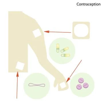 Different Items of Contraception and Birth Control Stock Illustration