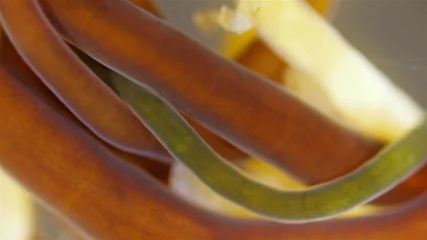 Different Nemertea worms under microscope. White Sea Stock Footage 296804236