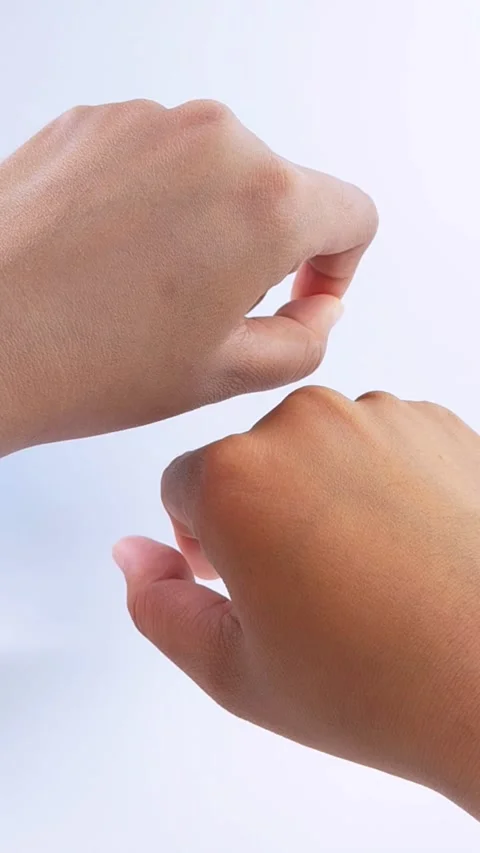 Different skin tones on both hands after using brightening cream. Vídeos de archivo 335388886