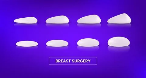 Different types and sizes of silicone breast implants round shape and teardrop Illustration