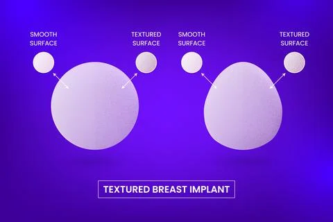 Different types and textured surfaces of silicone breast implants, round and Illustration
