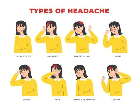 Different types of headache set collection, medical poster and infographic... Stock Illustration