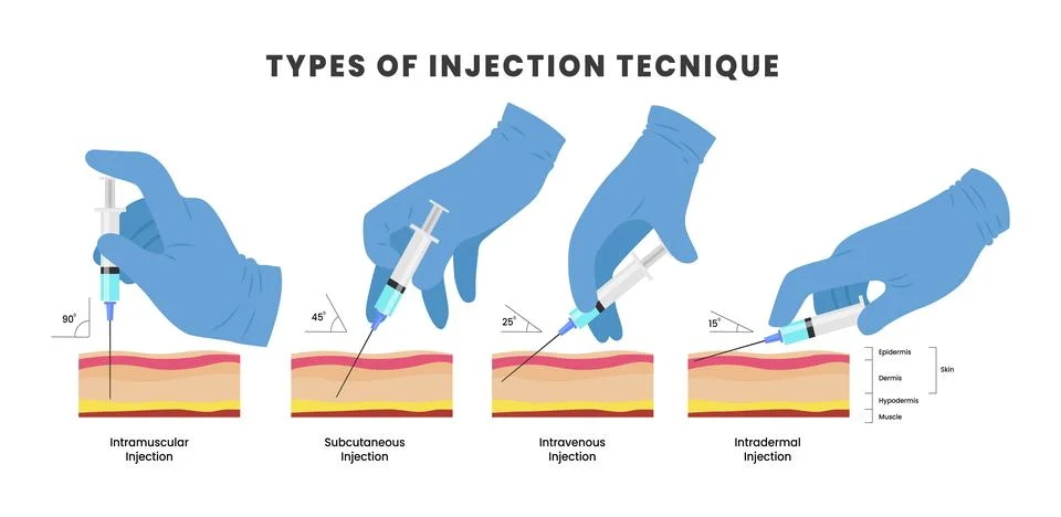 Different types of injection technique poster or medical banner scheme, wit.. Stock Illustration