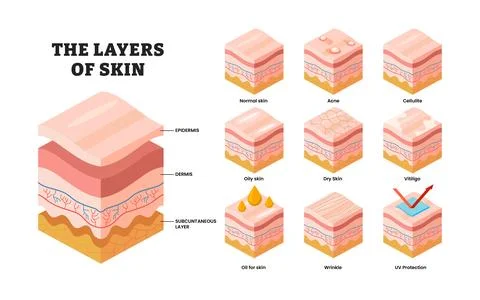 Different types of layer skins structure anatomy with isometric view, educa.. Stock Illustration