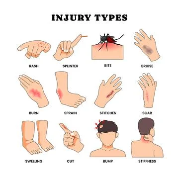 Different types of physical injury types poster for education vocabulary wo.. Stock Illustration