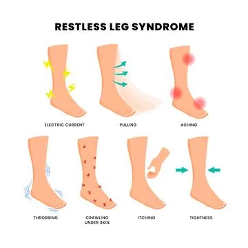 Different types of restless leg syndrome poster, medical banner infographic.. Stock Illustration