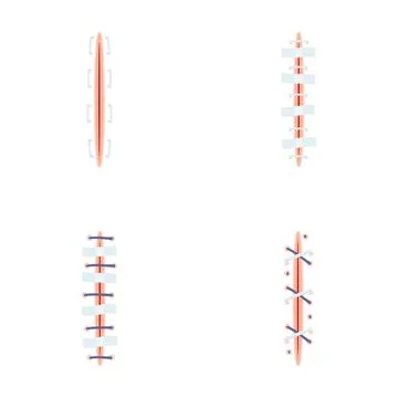Different types of surgical wound closure stitching methods Stock Illustration