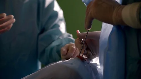 Difficult endscopic operation. Stock Footage 83252206