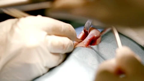 Difficult plastic surgery in a clinic. Stock Footage 83406032