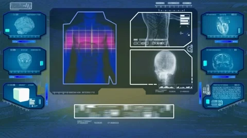 Digestion Analysis  - High Tech Scan - Blue 00 Stock Footage 58506162