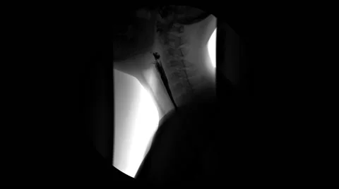 Digestive Fluoroscopy X-rays by the side Stock-Footage 56347613