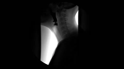 Digestive Fluoroscopy X-rays by the side Stock-Footage 56347616