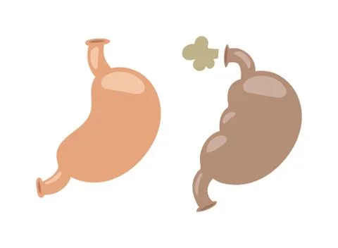 Digestive problems vector illustration Stock Illustration