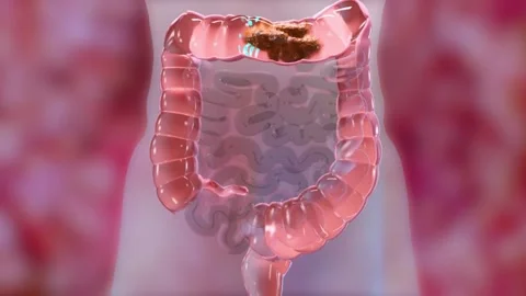 Digestive-System-Food-Waste Stock Footage 314067759