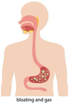 Digestive System Illustration with Bloating and Gas Stock Illustration