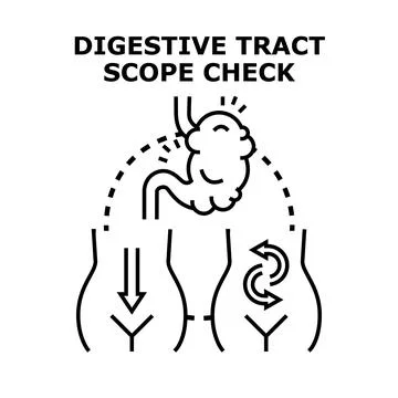 Digestive tract scope checking procedure medical concept Stock-Illustration