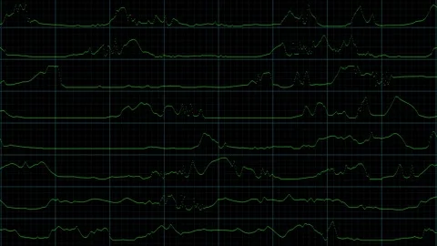 Digital audio waveform visualization on a dark background Vidéo 345168393