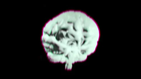 Digital Brain with Shaky Glitch, Cyber Security Concept 3d animation Stock Footage 304222048
