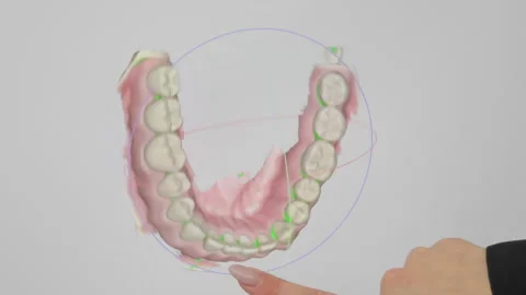 Digital Dental 3D Scan Visualization, Teeth Structure Displayed on Touchscreen Stock Footage 311694511