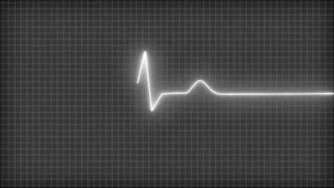 Digital ECG Display with Flatline and Spike, Neon Glowing Heartbeat Pulse W.. Stock Footage 314657008
