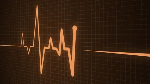 Digital ECG Waveform on Grid Background Animation, A digital electrocardiog.. 動画素材 305164681
