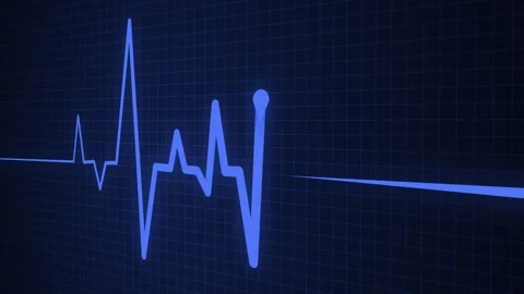 Digital ECG Waveform on Grid Background Animation, A digital electrocardiog.. 스톡 동영상 305172518