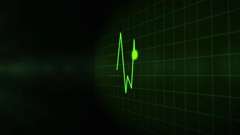 Digital EKG Pulse Copy space Stock Footage 157481093