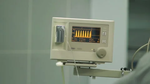 Digital equipment controls important vital signs in surgery Stock Footage 101295720