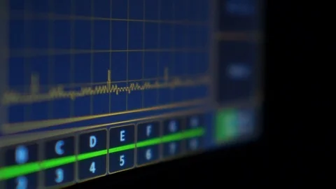 Digital graph scrolling past on a computer monitor indicating the status Stock Footage 123305127