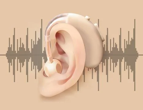 Digital hearing aid behind the ear. Ear and sound amplifier on background of Stock Illustration