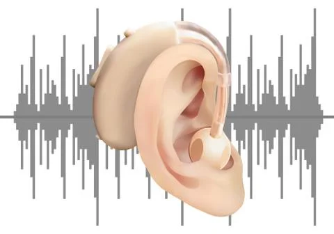 Digital hearing aid behind the ear, on the background of sound wave diagram Stock Illustration