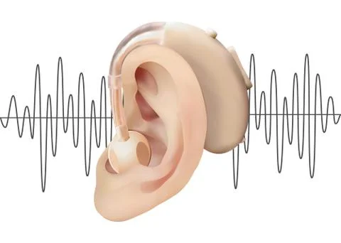 Digital hearing aid behind the ear, on the background of sound wave diagram Stock Illustration