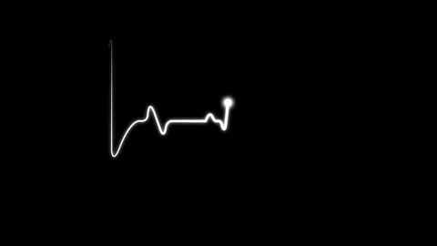 Digital heartbeat plus animation. Heart Beat Pulse animated video, medical .. Stock Footage 327758096