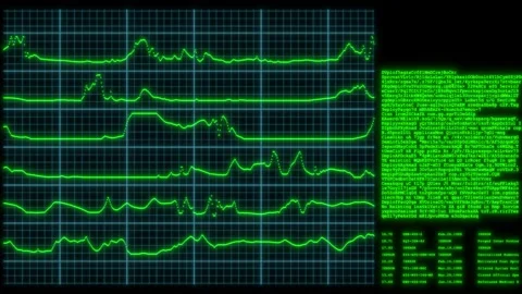 Digital interface with green waveform graphs and data text Stock Footage 345168392