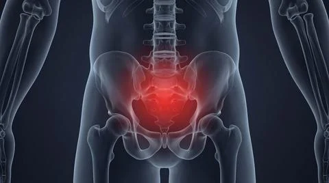 Digital scan of human pelvis and lower back indicating severe joint discomf.. Stock Illustration