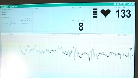 Digital scanning heart rate human using computer patient health data Stock Footage 149045990